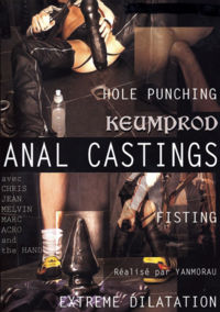 Anal Castings